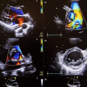 Formation Echographie générale et FAST en situation d’urgence